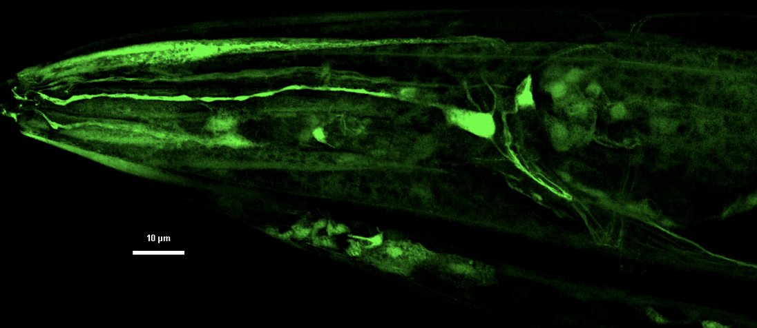 Fluorescent GFP reporters visualizing insulin-like peptide expression in C. elegans