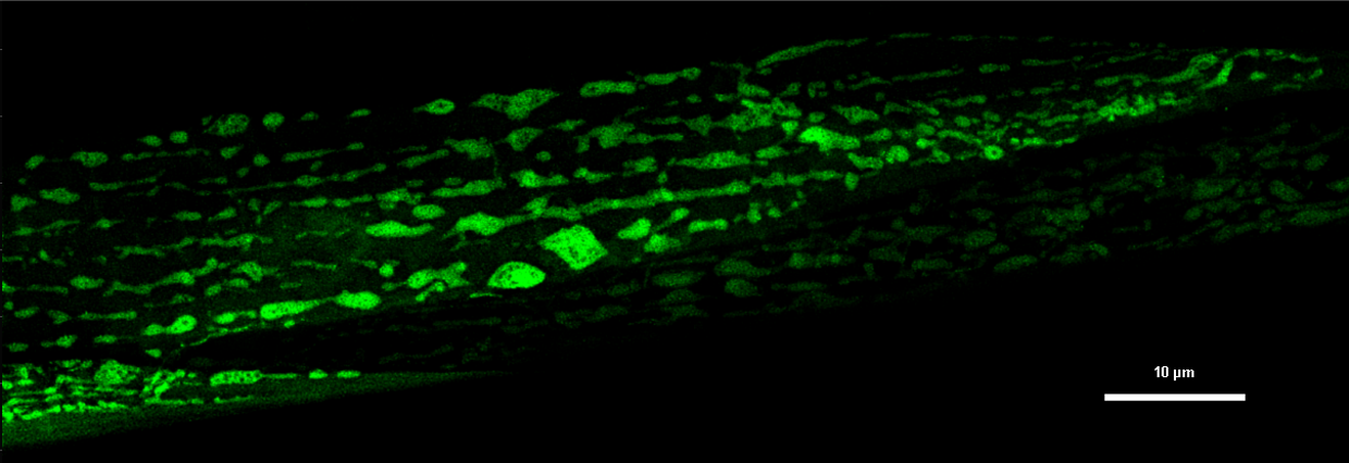 High-resolution imaging of mitochondria in C. elegans